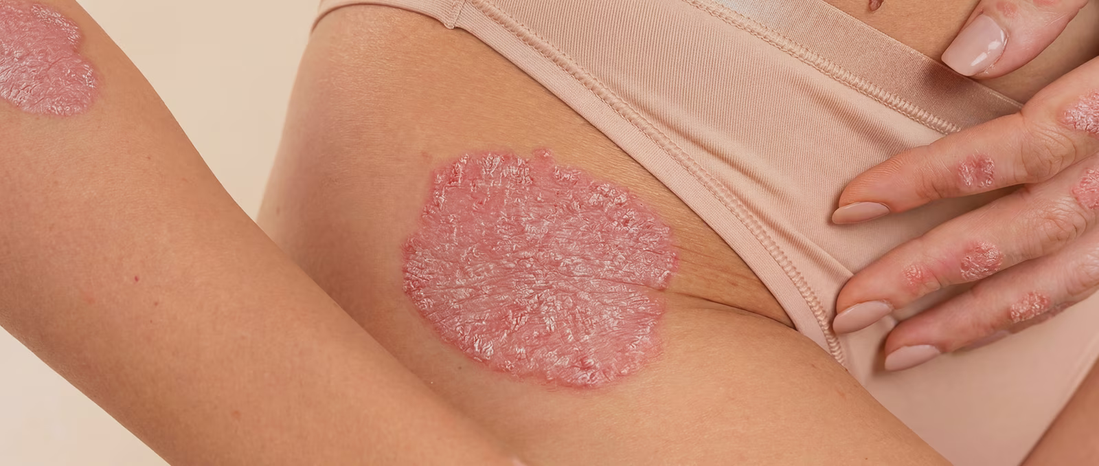 Skin before treatment